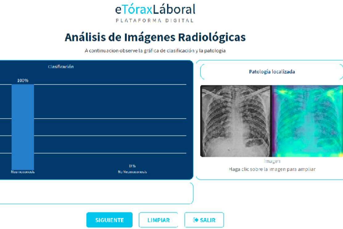 La innovadora herramienta para la detección temprana de neumoconiosis de Convicción Digital